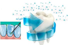 وارنیش تراپی دانش آموزان توسط پایگاه سلامت